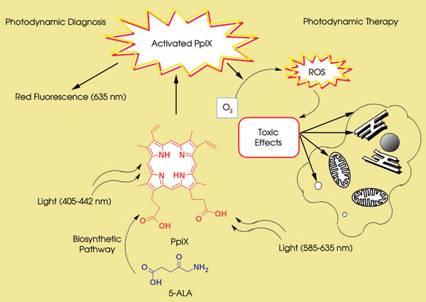 Prospects for Photodynamic Therapy in Dentistry