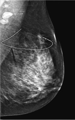 Medical Device Companies Try Peering into the Future