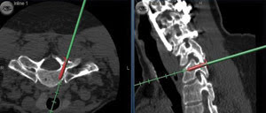 Getting the complete picture