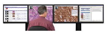 Digital Pathology Is Growing Despite Fears