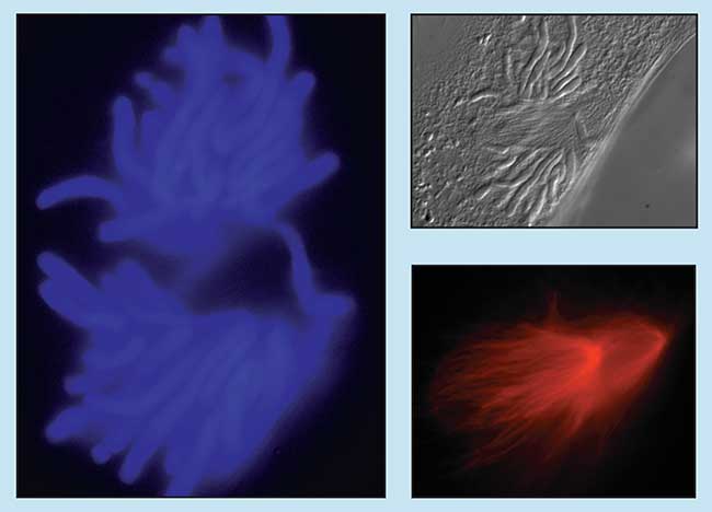 Microscopists regularly employ CCD cameras to collect images using a variety of contrast enhancement methods. 