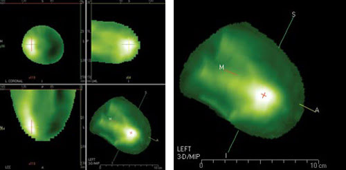 The Long and Short of Biomedical Imaging