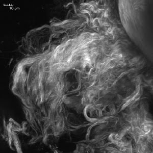 Combining Second-Harmonic Generation with Multiphoton Imaging