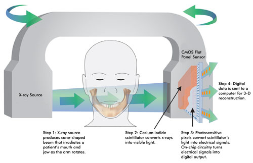 CMOS technology for digital dental imaging