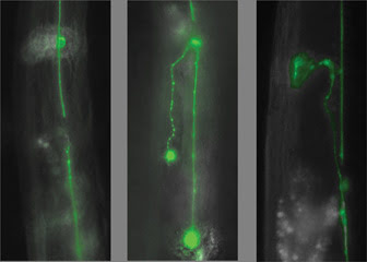 Nanosurgery operates at the cutting edge of medicine