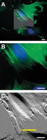 Bioapplications of Combined Optical and AFM Imaging Techniques
