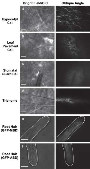 Improving Plant Cell Analysis Requires Good TIRF