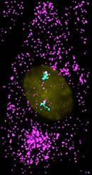 NIH Grants $12.5M for Optogenetics, Imaging, Tumor Detection