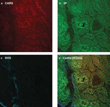To Label – or Not?