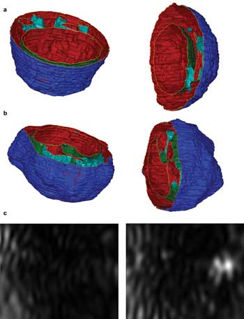 Diffraction-Imaging Flow Cytometry Enables Rapid Cell Assay