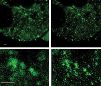 Confocal microscopy gets smaller and faster – and branches out