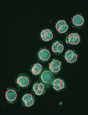 Time-Lapse Microscopy Captures Cells in the Act