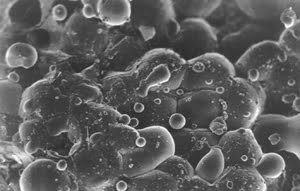 With lasers, surgery on the cutting edge