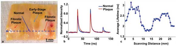 Optical Spectroscopy Gives a Sharp Gaze into Tissues