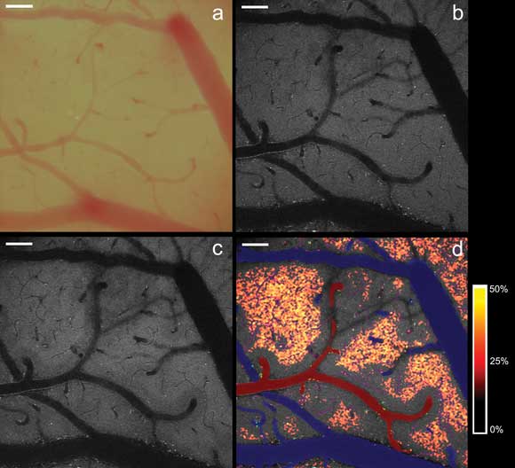 Intrinsic Fluorescence Lights Up Cellular Components