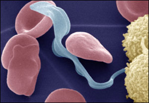 Colored electron micrograph of the bloodstream form of the Trypanosoma brucei parasite (light blue) that causes African trypanosomiasis (also called sleeping sickness) in humans in the presence of erythrocytes (red) and lymphocytes (yellow). 