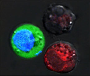 After the laser pulse, red-stained cells show evidence of massive damage from exploding nanobubbles, while blue-stained cells remained intact, but with green fluorescent dye pulled in from the outside. 