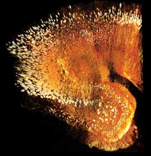 3-D Microscopy Goes Deeper and Deeper