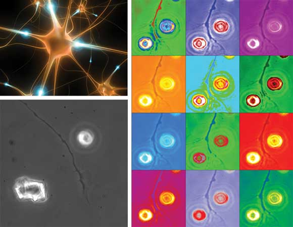 Collaboration Sparks Nerve-Fiber “Turn Signal” Discovery