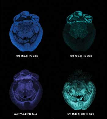 Maldi-MS Making a Strong Comeback