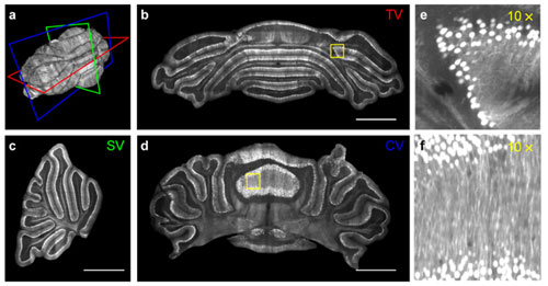 Micron-scale neuroanatomy of a whole thy1-GFP-M brain. 