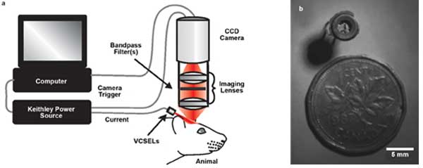VCSEL-Based Imaging System Monitors Brain Activity