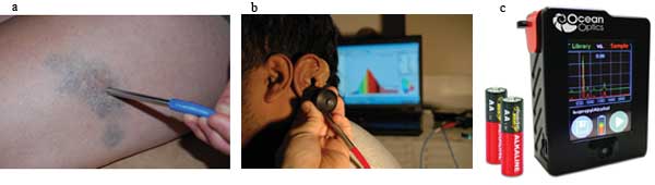 Noninvasive UV-VIS spectroscopy