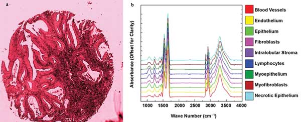 Trends in Spectroscopy: IR, UV-VIS Techniques Are Safe, Speedy and Skin-Deep