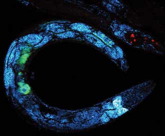 Trends in Microscopy: A Big Market, Focused on the Very Small