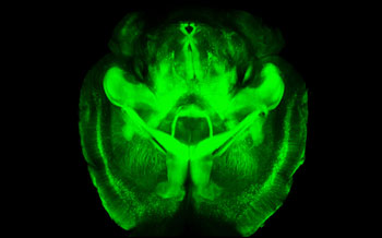A 3-D rendering of clarified brain imaged from below (ventral half).