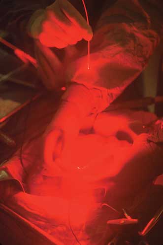 Q&A: Market Growing Slowly for PDT