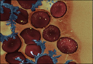 DNA-controlled nanoparticles developed at MIT work as a two-way switch for blood clotting.