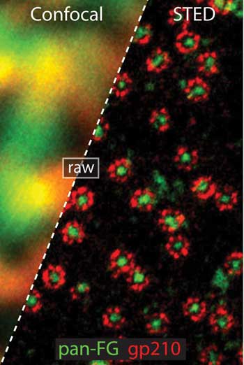 STED Microscopy: A New Chapter in Light Imaging