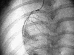 Magnification Fluoroscopy Technique Drives Advances in Clinical Studies