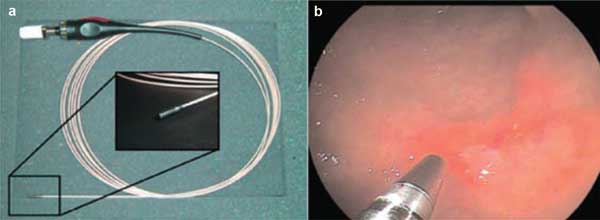 Looking Down the Endoscope
