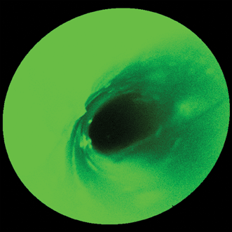 autofluorescence mitigation