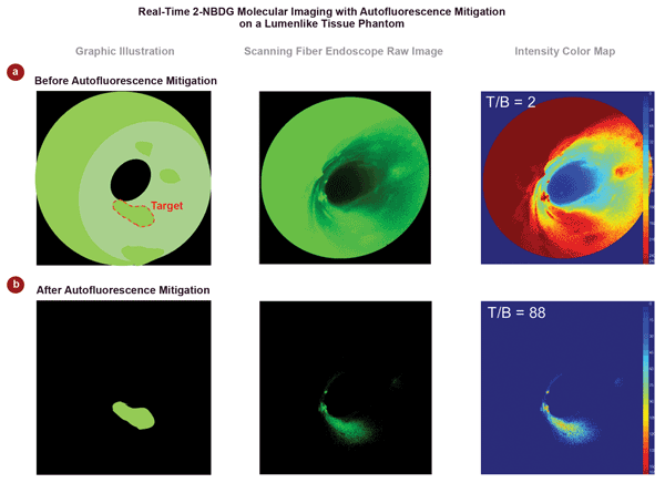 Laser Combiner Enables Scanning Fluorescence Endoscopy