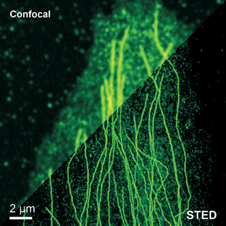 STED Microscopy