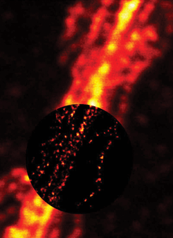 superresolution STED microscopy