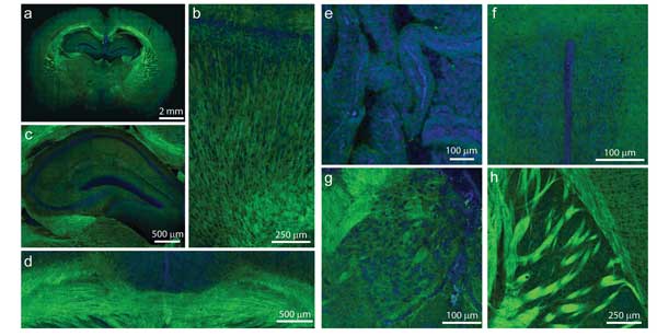 Raman Technique Offers Promise for Clinical Applications