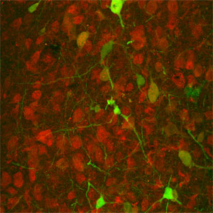Optogenetics Allows Light to Switch Off Anxiety