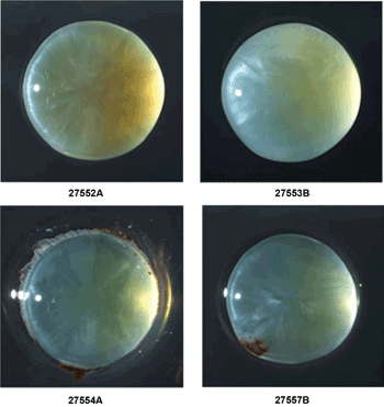 Seeing the Light: How Photonics Continues to Improve Eyesight
