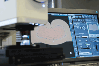 Optodigital Microscopy Enhances Efficiency of Material Testing