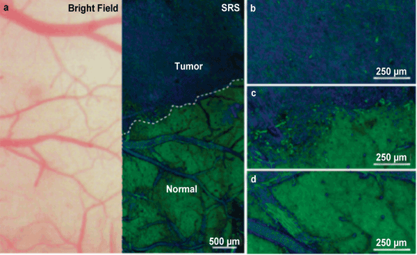 Comparison of a bright-field microscopy image of a mouse brain with stimulated Raman scattering (SRS) microscopy