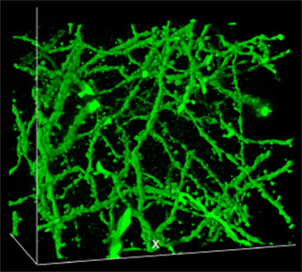 3-D confocal image of an expanded brain sample