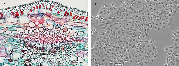 Bright field microscope images depicting stained slides (a) and a phase contrast image of cells in a migration chamber (b).