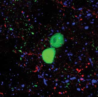 Section of the mammalian spinal cord taken at high magnification (63×), showing individually labeled cells (large, green) and their local synapses (small, green puncta).