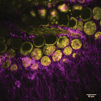 SHG and THG label-free imaging reveals structural details of a mouse mammary gland, including collagen (in magenta) and adipocytes (in yellow).