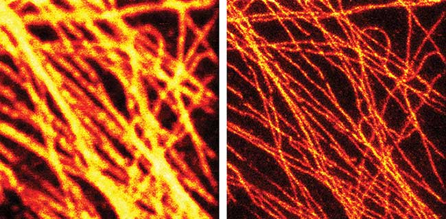 The effectiveness of STED is clear in this pair of images of fluorescently tagged microtubuli in mammalian cells