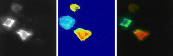 Three cells labelled with FRET pairs: the left image shows the donor fluorescence, which does not indicate whether FRET has occurred or not.